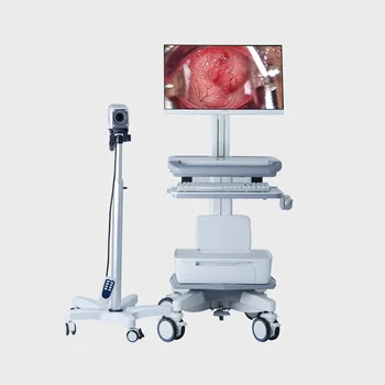 Эндоскопическое оборудование Хирургия Эндоскопия Цифровая с заводской ценой